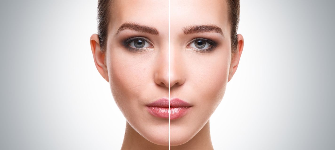 Hydrafacial Before and After: Real Client Results