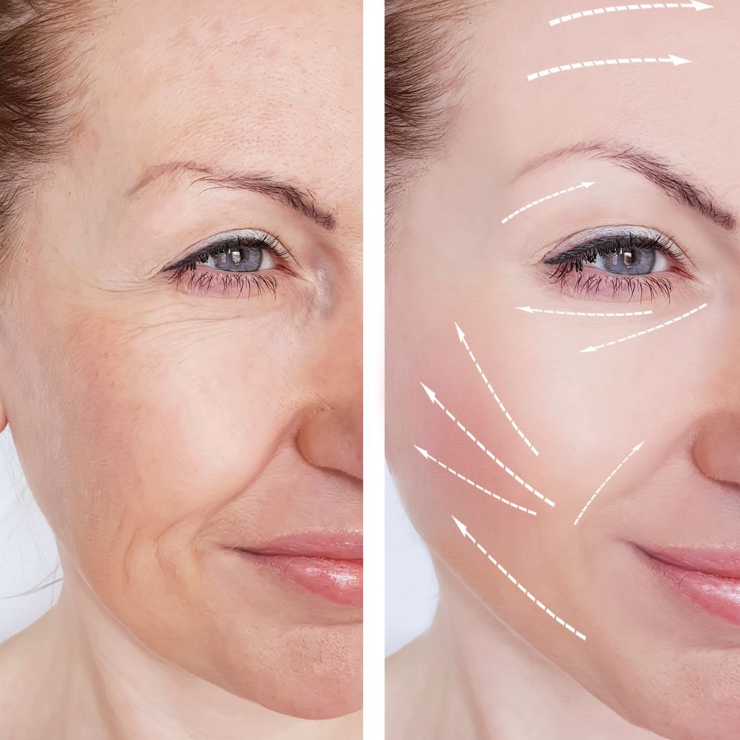 Hydrafacial Before and After: Real Client Results