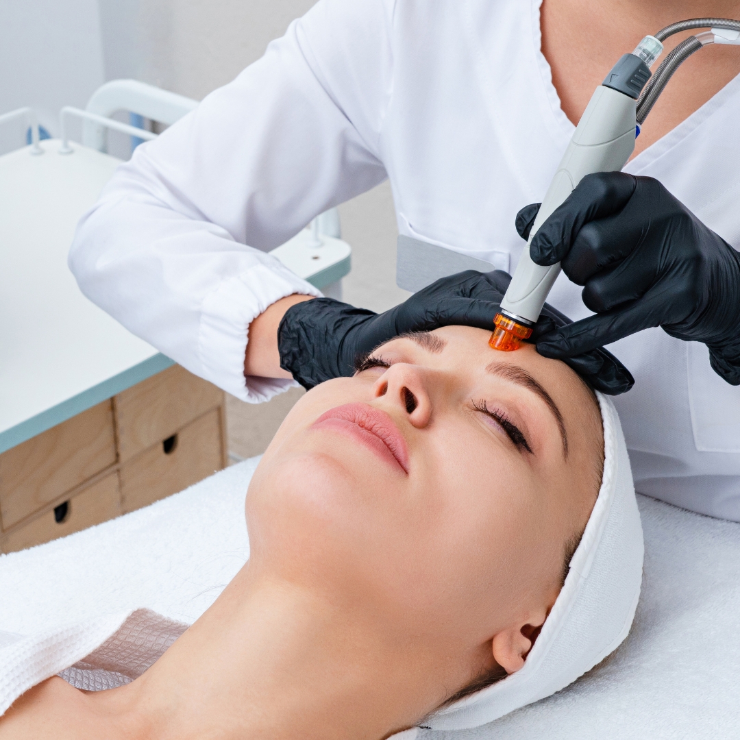 Is Hydrafacial Safe for Sensitive Skin? Everything You Need to Know