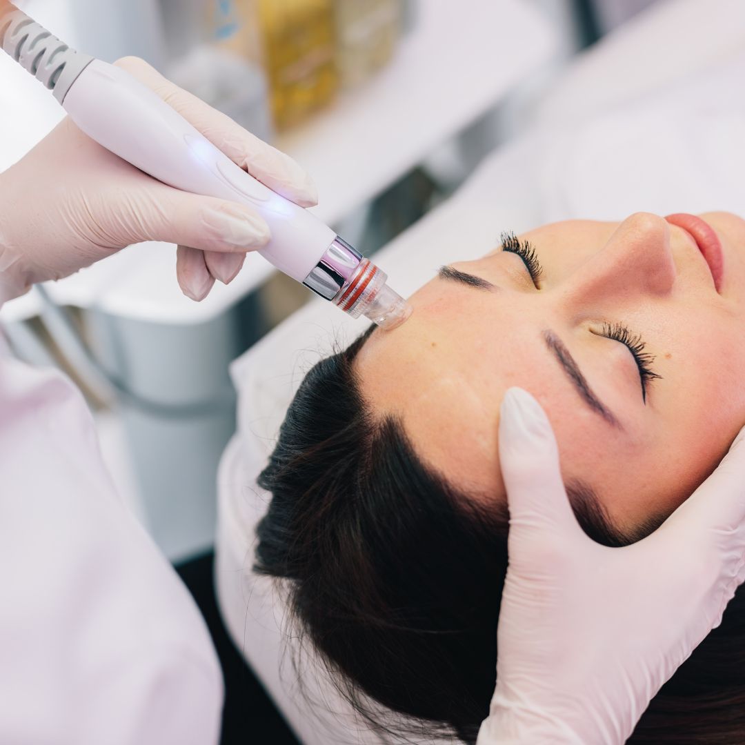 The Secret to Radiant Skin? Hydration—And Hydrafacial Nails It