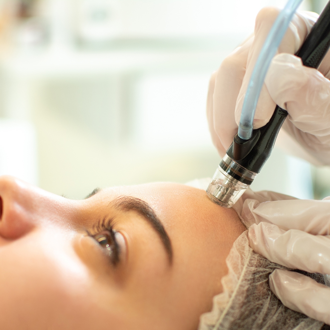 Why HydraFacial is the Go-To Treatment Before Special Events and Photoshoots in Bangkok